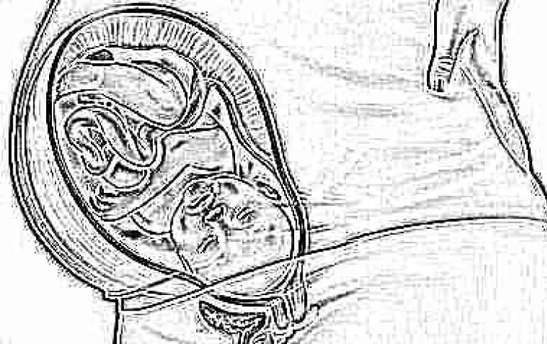 Pathology of attachment of the umbilical cord to the placenta Attachment of the umbilical cord to the placenta